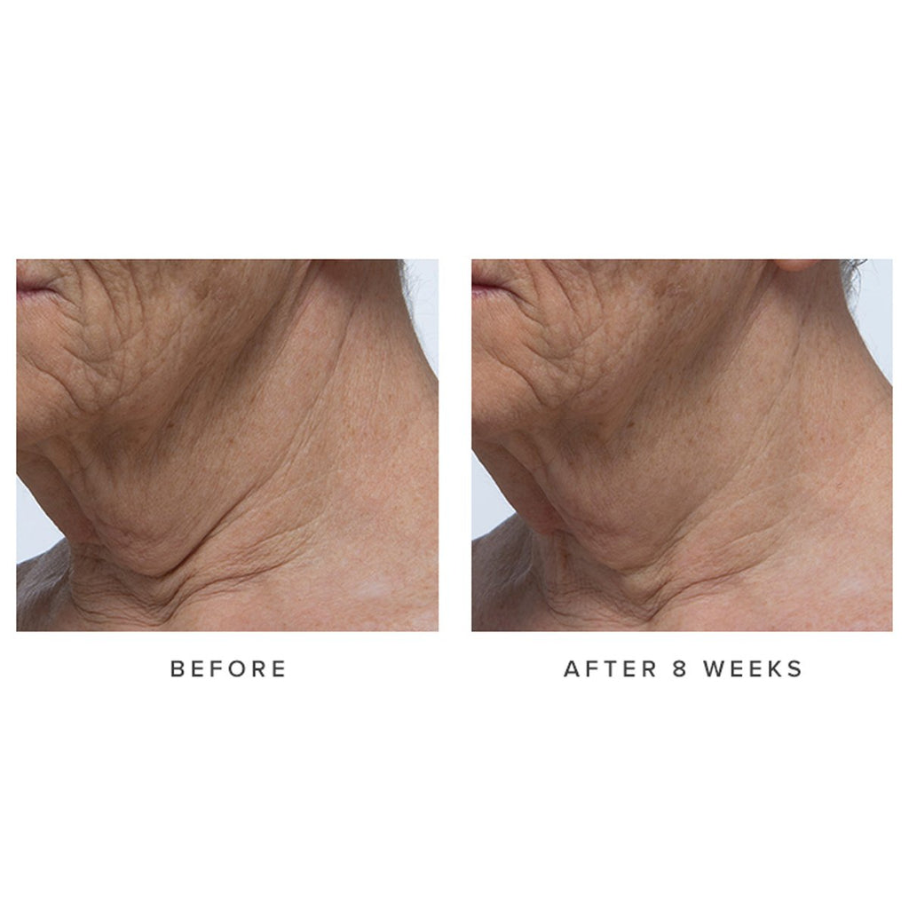 Ageless Revitalizing Neck Cream | Fresh Routine Favorite