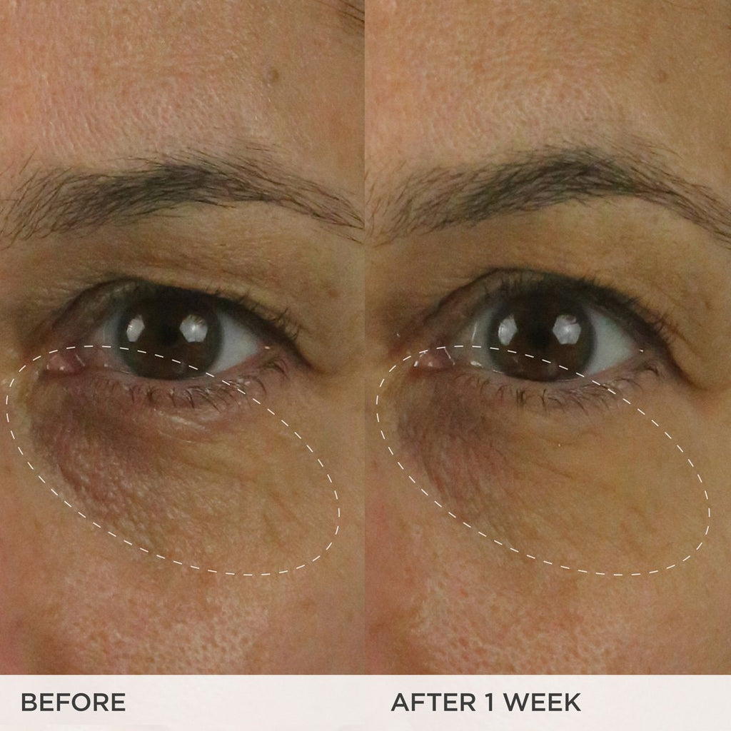 The Brightening Eye Cream | Fresh Routine Favorite