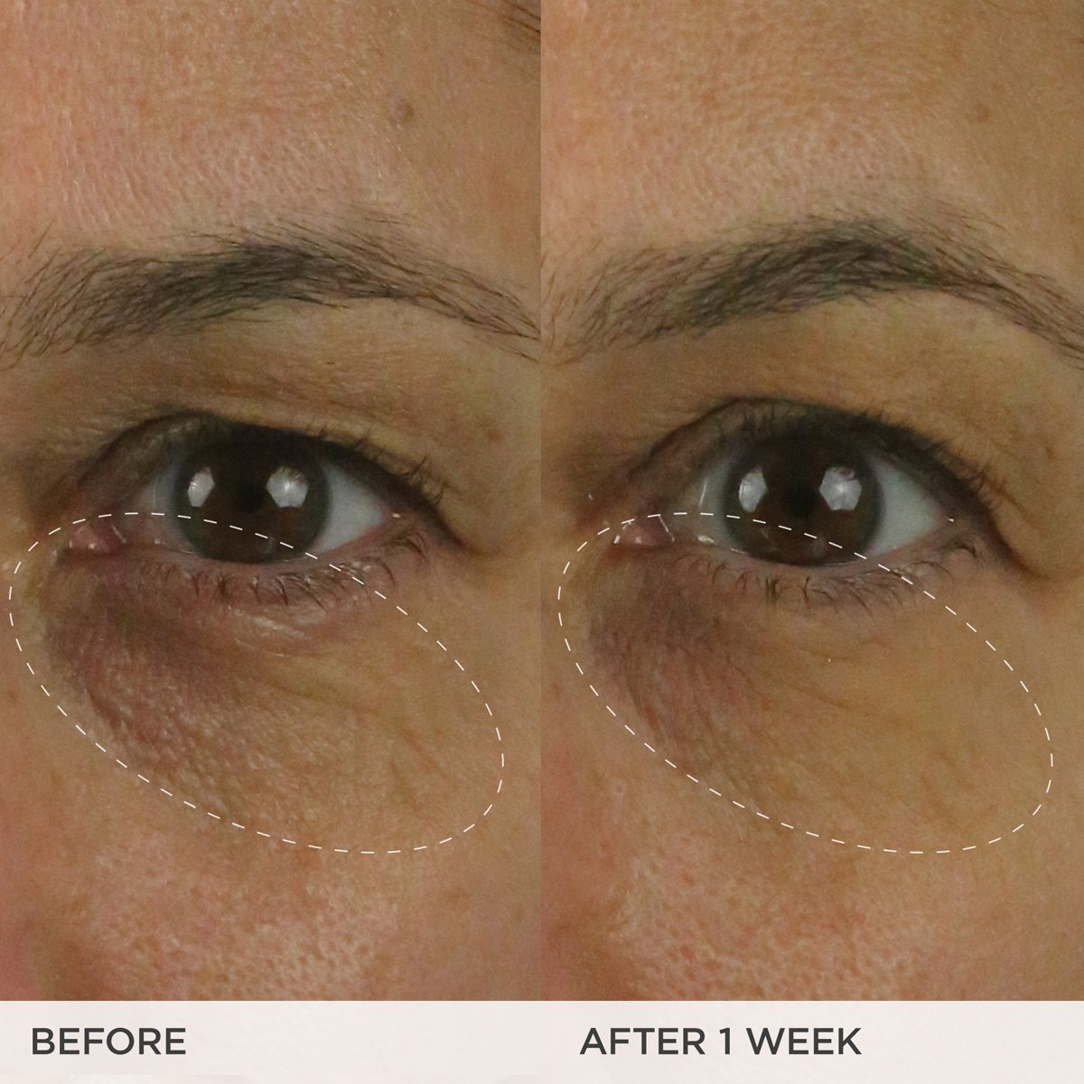 The Brightening Eye Cream | Fresh Routine Favorite