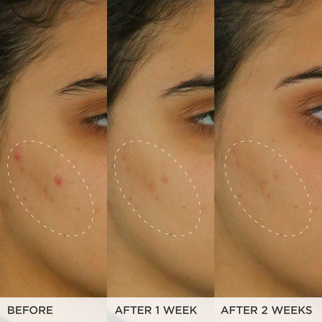The Brightening Serum | Fresh Routine Favorite