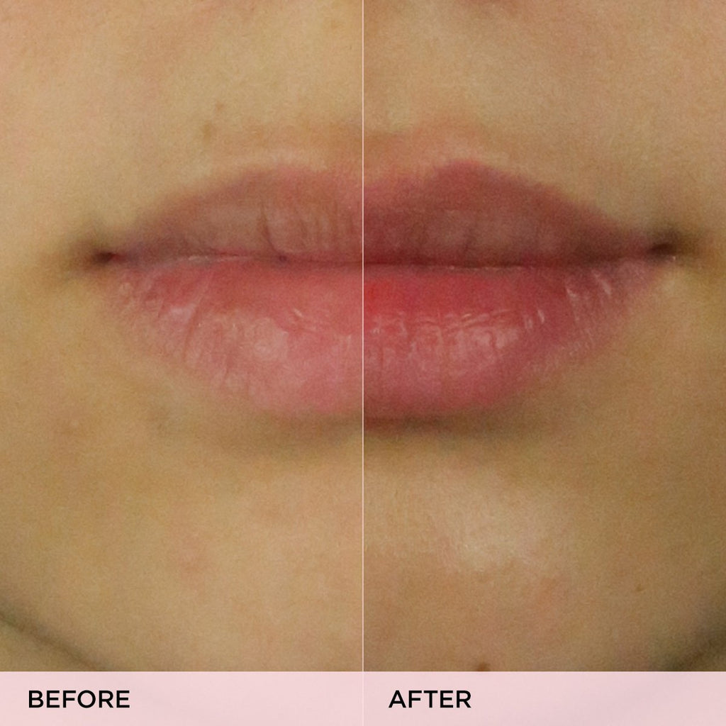 The Kissu Lip Scrub | Fresh Routine Favorite