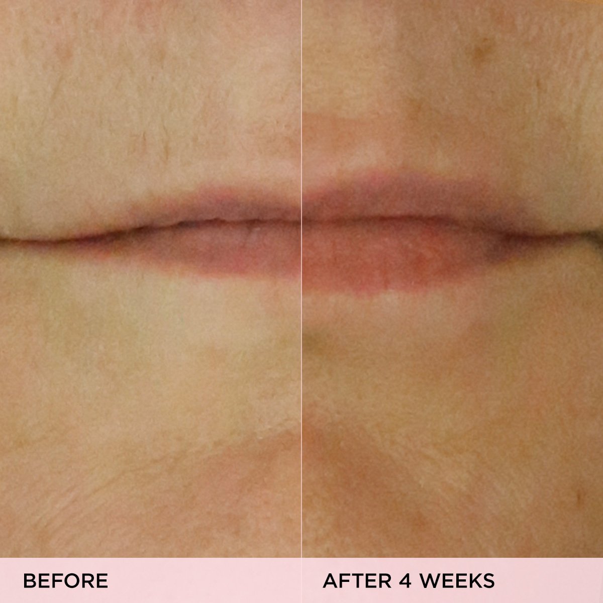 The Kissu Lip Treatment | Fresh Routine Favorite